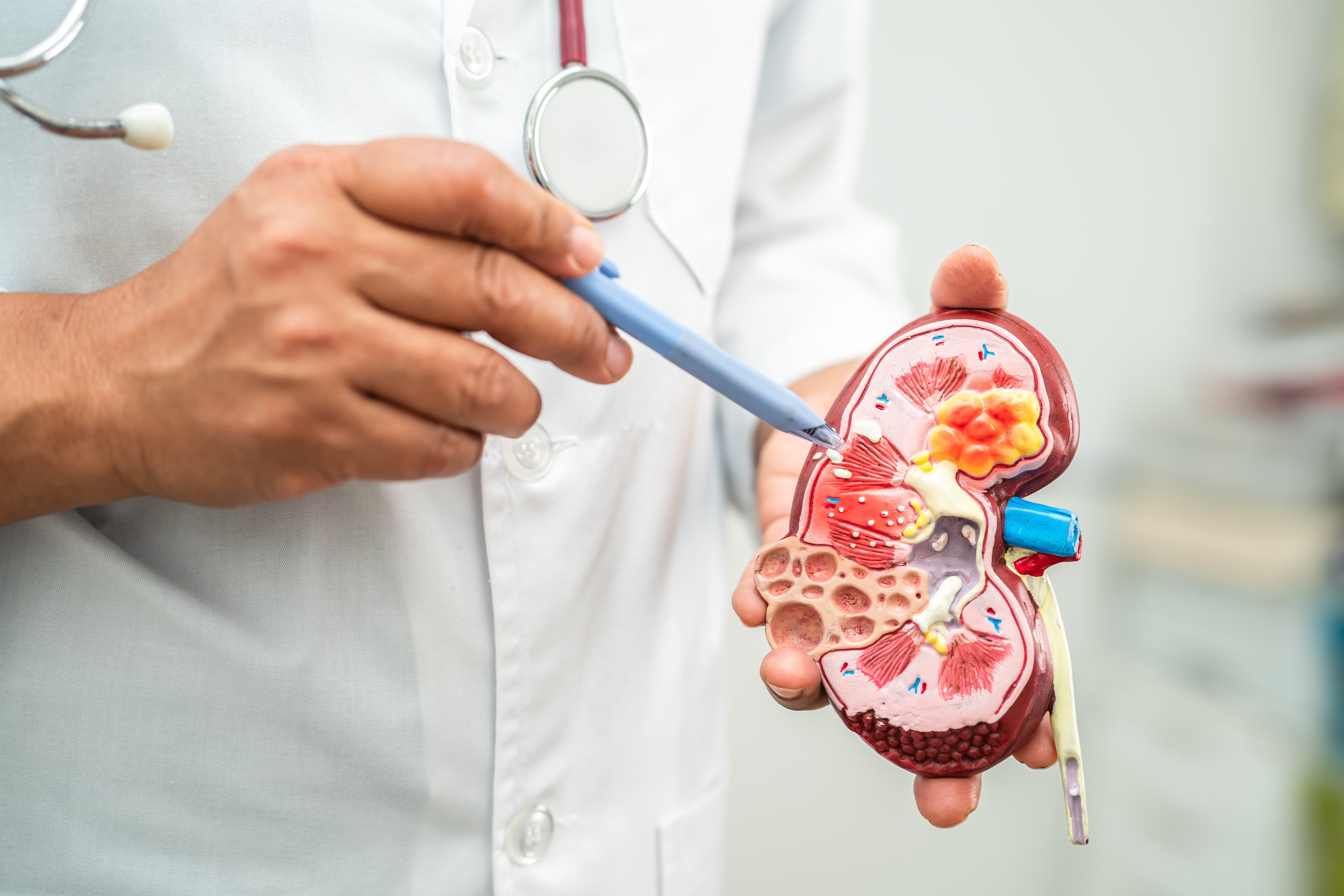 How Nephrology Billing & Coding Cuts Errors